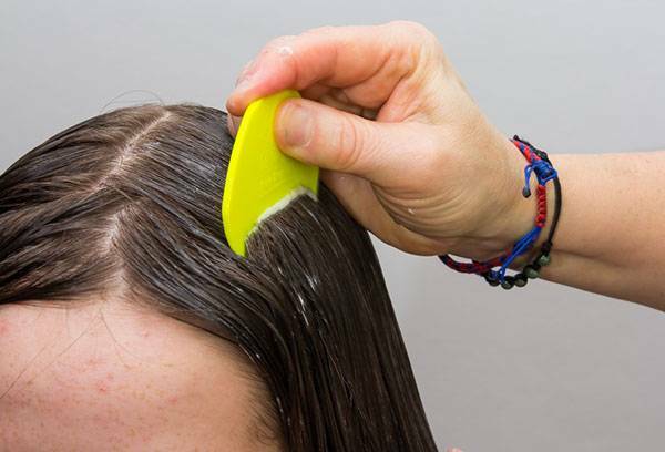 How to get rid of lice and nits quickly - 10 ways