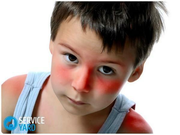Red spots in the child