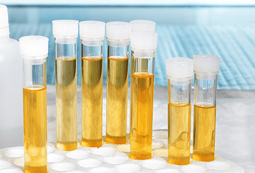 Kuidas analüüsida uriini enne laborile üleandmist