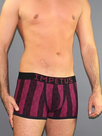 Men's briefs hips Impetus 1234482 burgundy