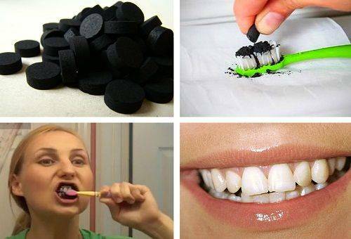 Balinimas dantis su aktyvuota medžio anglimi namuose - tai įmanoma ir kaip dažnai