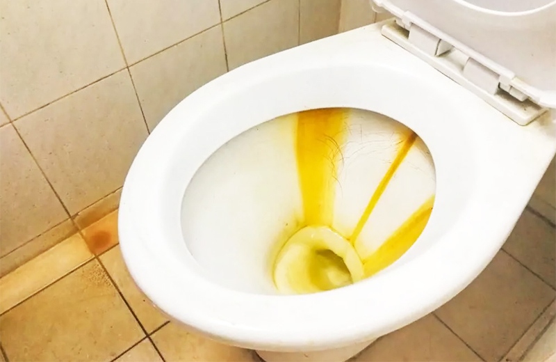 Hoe tandplak in het toilet te verwijderen?
