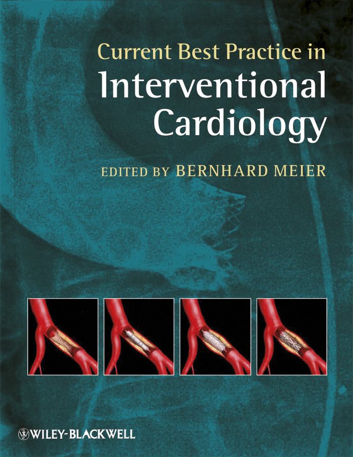 Nuvarande bästa praxis inom interventionell kardiologi