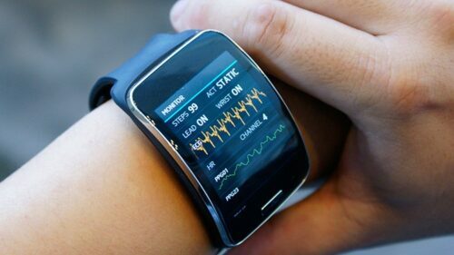 Smartwatch Xiaomi - am besten bewerteten 5-Modelle